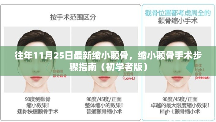 初学者指南,缩小颧骨手术步骤详解,历年经验总结助你轻松应对手术挑战