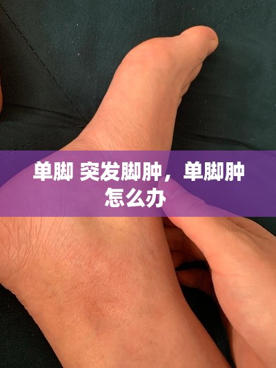 单脚 突发脚肿,单脚肿怎么办